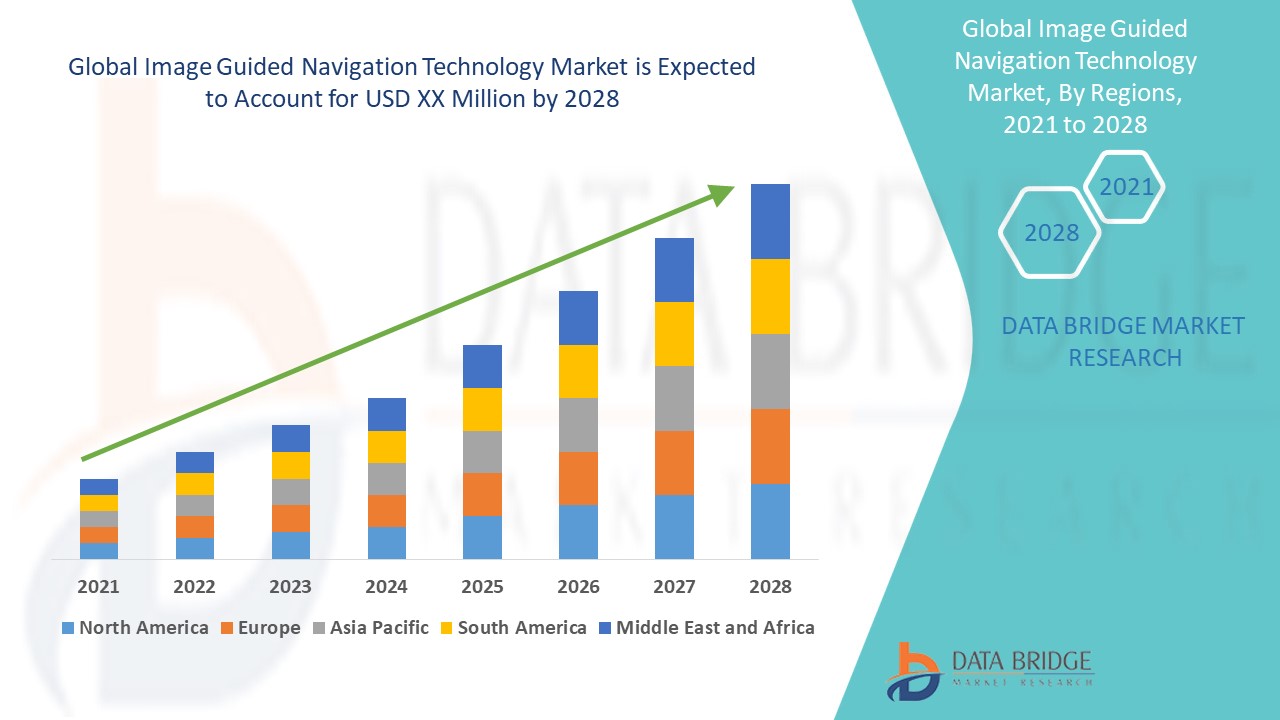 Marché des technologies de navigation guidée par l'image
