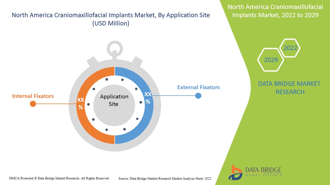 North America Craniomaxillofacial Implants Market 