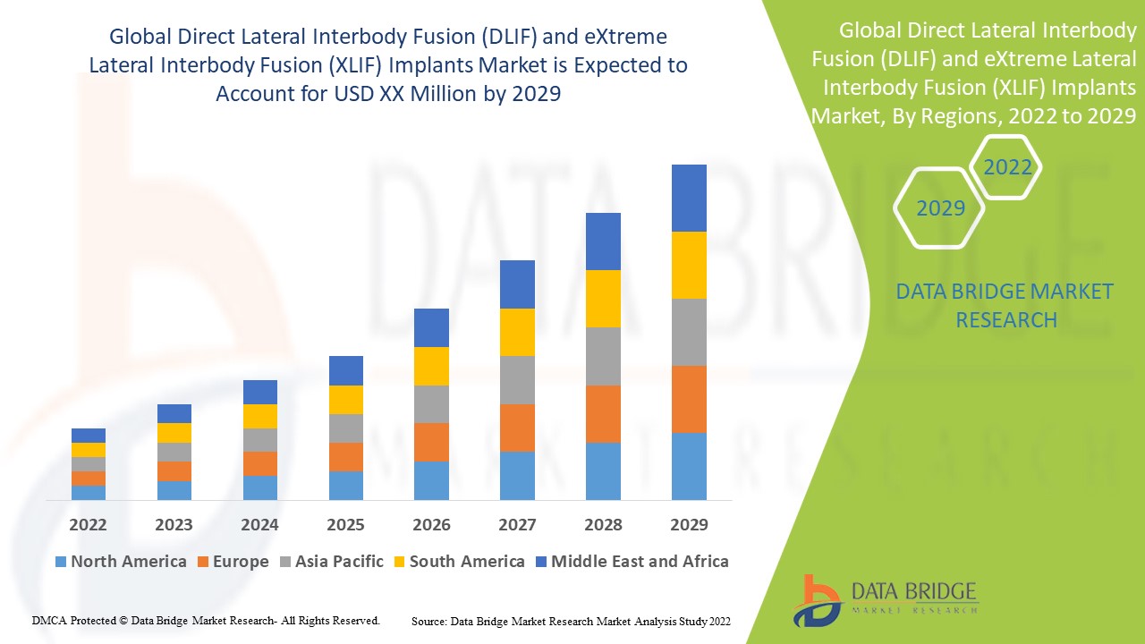 Markt für Implantate für die direkte laterale interkorporelle Fusion (DLIF) und die extreme laterale interkorporelle Fusion (XLIF)