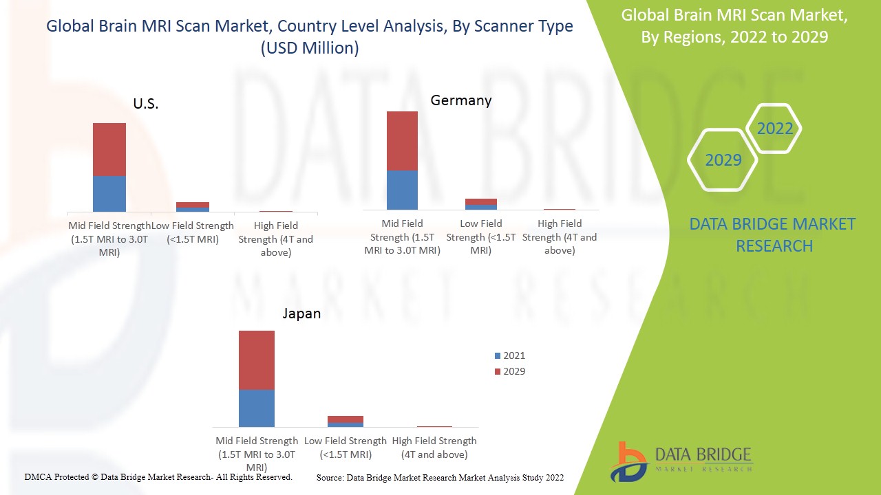 Brain MRI Scan Market