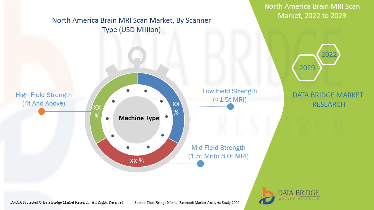 North America Brain MRI Scan Market