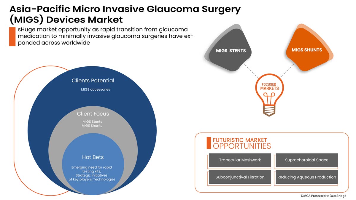Micro Invasive Glaucoma Surgery (MIGS) Devices Market