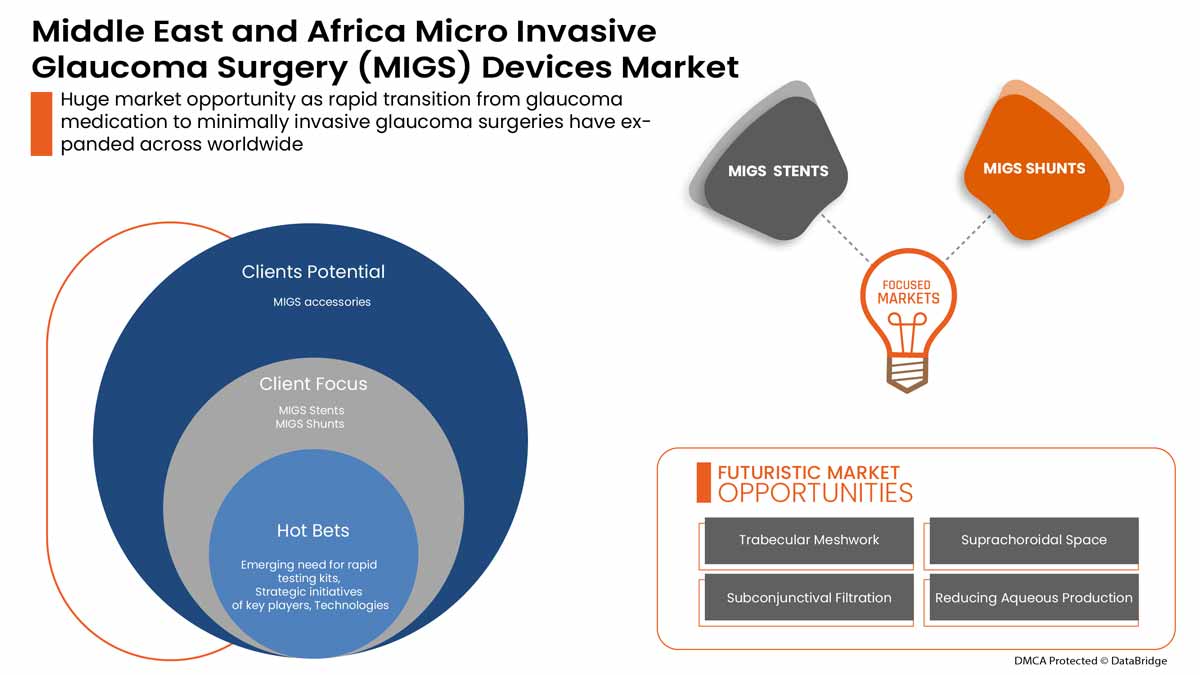Micro Invasive Glaucoma Surgery (MIGS) Devices Market