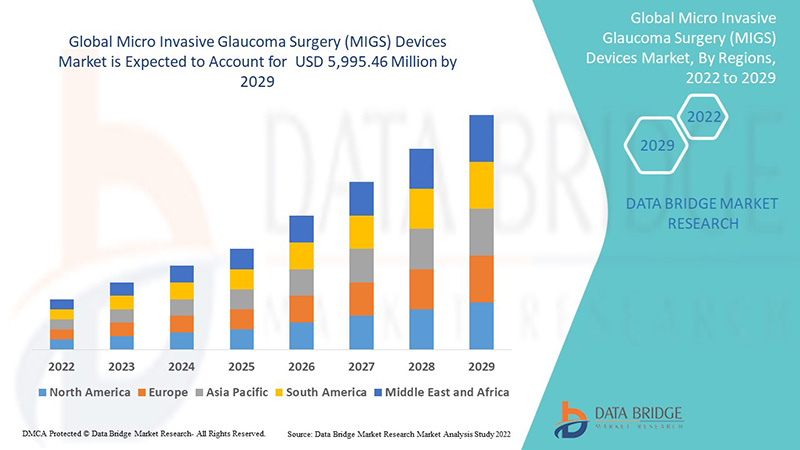 Micro Invasive Glaucoma Surgery (MIGS) Devices Market