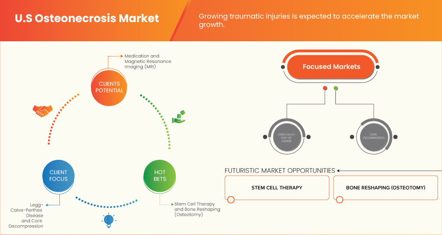 Mercado de osteonecrosis en EE.UU.